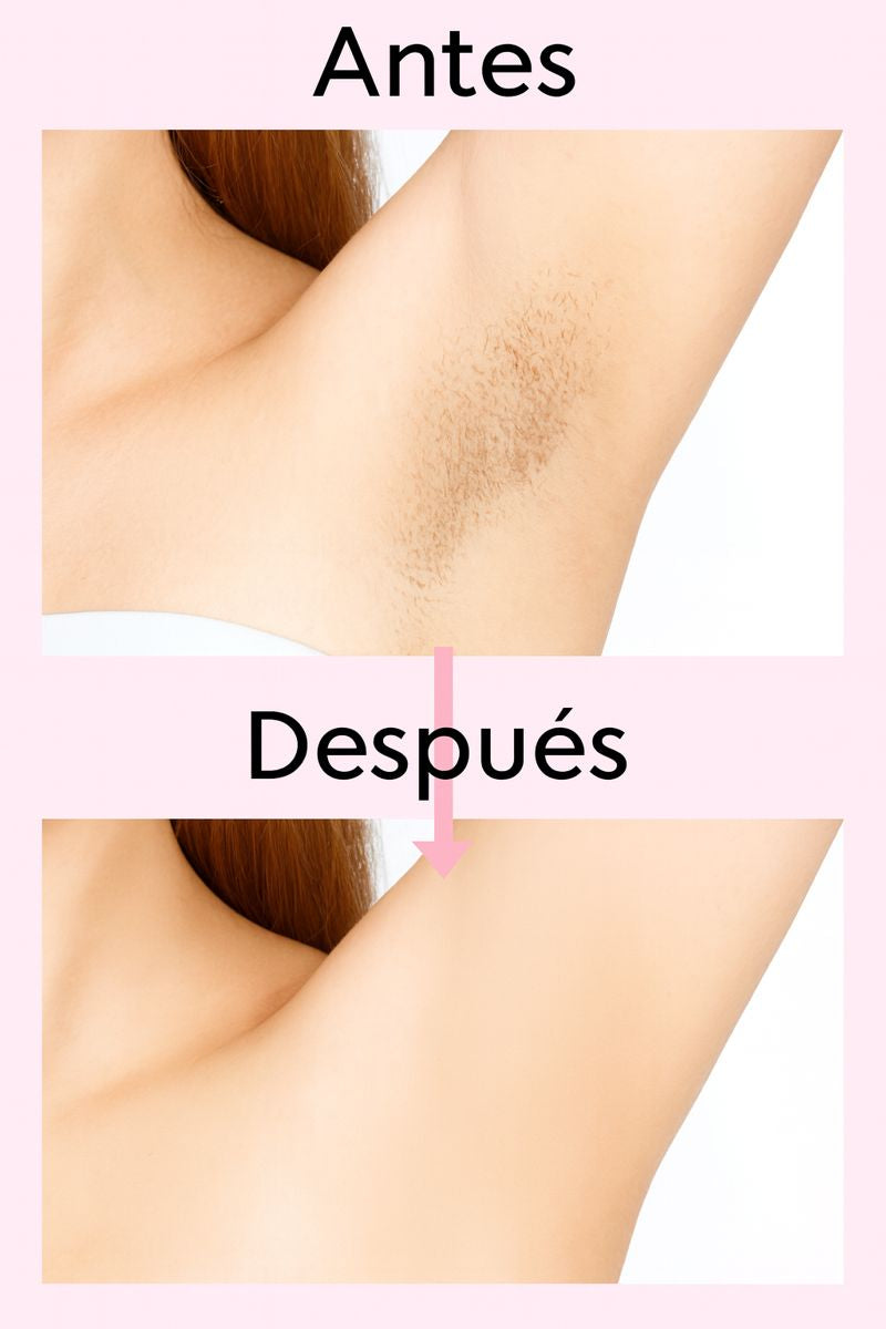 Aceite para Después de la Depilación – OceAura