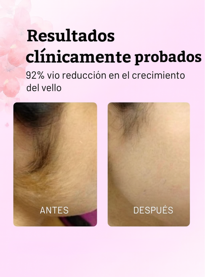 Aceite para Después de la Depilación – OceAura